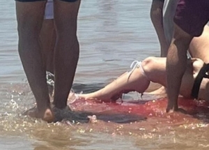 Tiburón ataca a 4 personas en una playa de Galveston, Texas; una mujer casi pierde la pierna