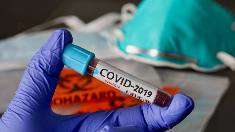 Laboratorios privados ya ofrecen la prueba de coronavirus