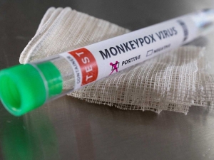 Canadá registra 77 casos de viruela del mono; &quot;situación preocupante&quot; en Quebec